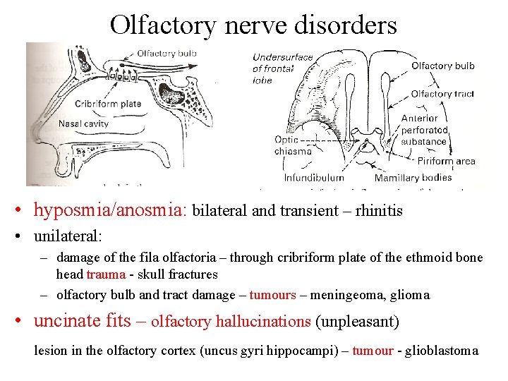 Olfactory nerve disorders • hyposmia/anosmia: bilateral and transient – rhinitis • unilateral: – damage Olfactory nerve disorders • hyposmia/anosmia: bilateral and transient – rhinitis • unilateral: – damage