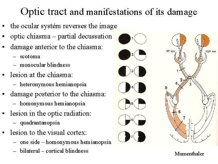 Optic tract and manifestations of its damage • the ocular systém reverses the image