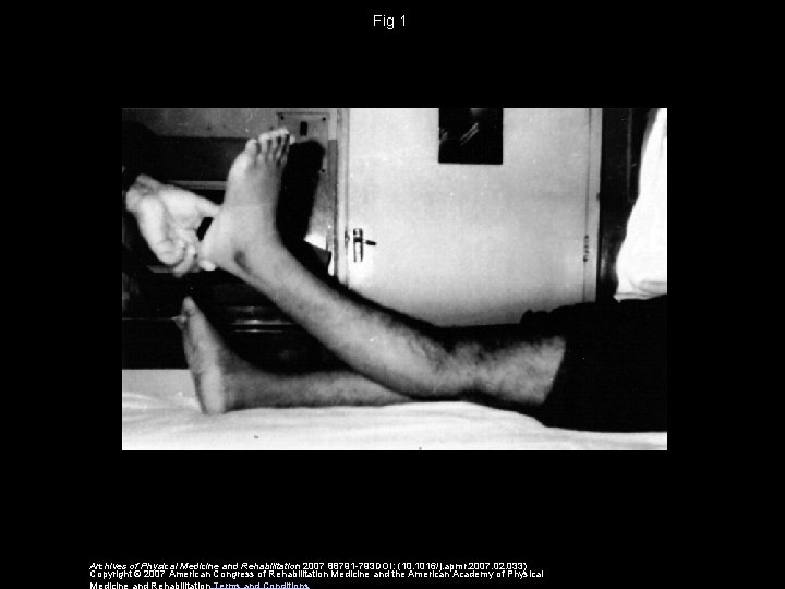 Fig 1 Archives of Physical Medicine and Rehabilitation 2007 88791 -793 DOI: (10. 1016/j.