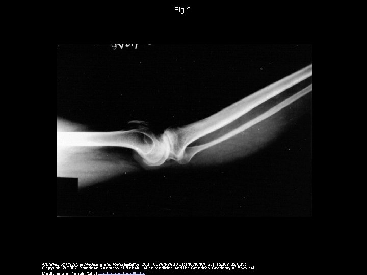 Fig 2 Archives of Physical Medicine and Rehabilitation 2007 88791 -793 DOI: (10. 1016/j.