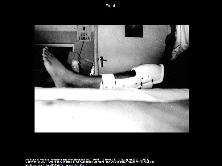 Fig 4 Archives of Physical Medicine and Rehabilitation 2007 88791 -793 DOI: (10. 1016/j.