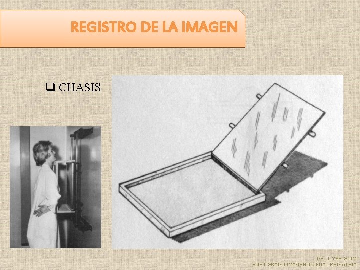 REGISTRO DE LA IMAGEN q CHASIS DR. J. YEE GUIM POST GRADO IMAGENOLOGIA -