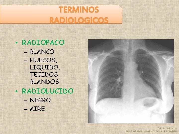 TERMINOS RADIOLOGICOS • RADIOPACO – BLANCO – HUESOS, LIQUIDO, TEJIDOS BLANDOS • RADIOLUCIDO –