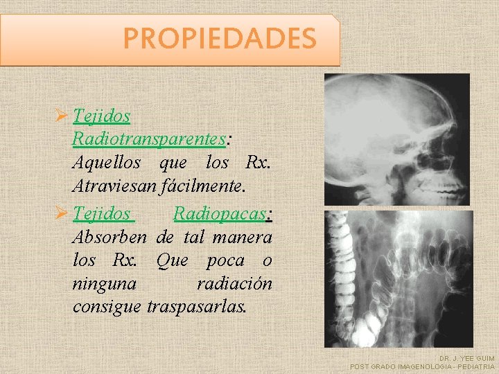PROPIEDADES Ø Tejidos Radiotransparentes: Aquellos que los Rx. Atraviesan fácilmente. Ø Tejidos Radiopacas: Absorben