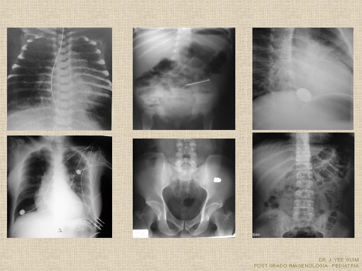 DR. J. YEE GUIM POST GRADO IMAGENOLOGIA - PEDIATRIA 