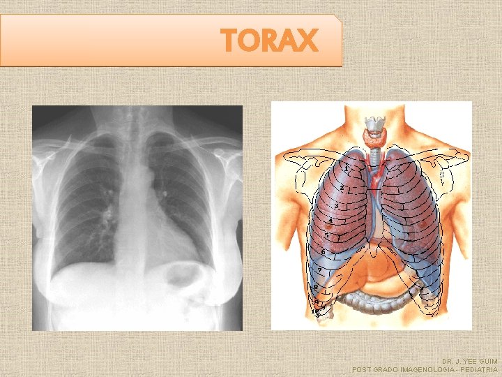 TORAX DR. J. YEE GUIM POST GRADO IMAGENOLOGIA - PEDIATRIA 