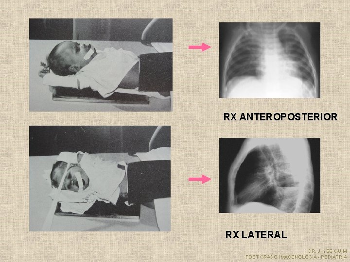 RX ANTEROPOSTERIOR RX LATERAL DR. J. YEE GUIM POST GRADO IMAGENOLOGIA - PEDIATRIA 
