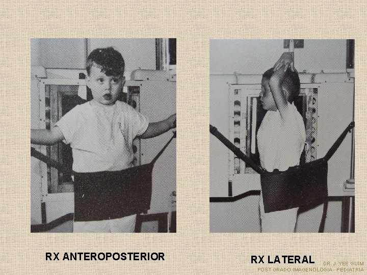RX ANTEROPOSTERIOR RX LATERAL DR. J. YEE GUIM POST GRADO IMAGENOLOGIA - PEDIATRIA 