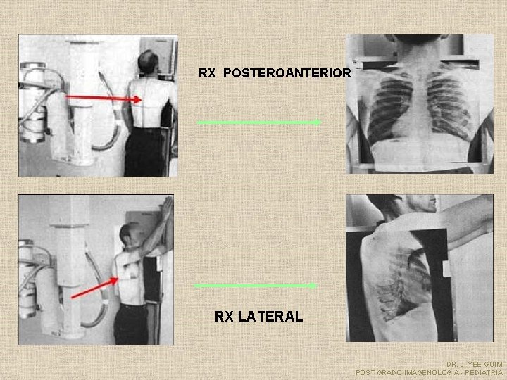 RX POSTEROANTERIOR RX LATERAL DR. J. YEE GUIM POST GRADO IMAGENOLOGIA - PEDIATRIA 