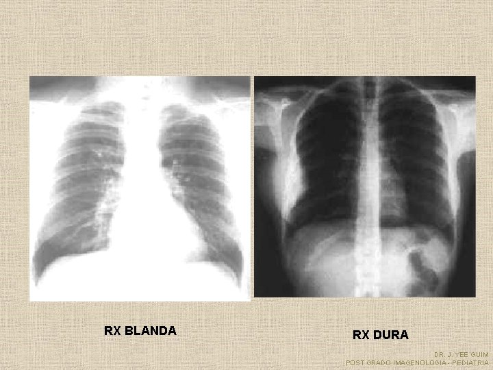 RX BLANDA RX DURA DR. J. YEE GUIM POST GRADO IMAGENOLOGIA - PEDIATRIA 
