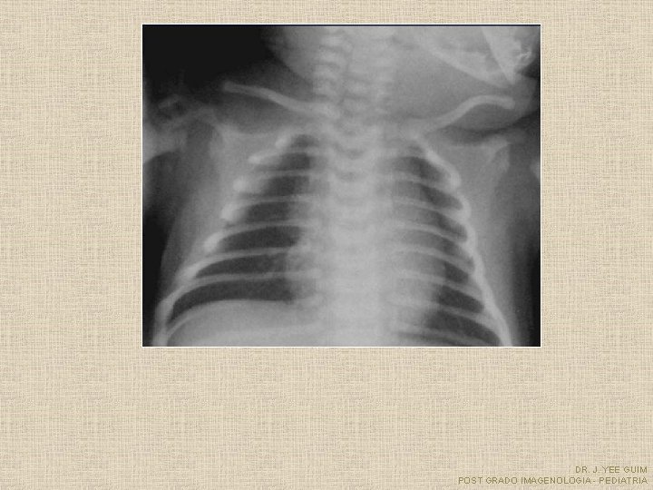 DR. J. YEE GUIM POST GRADO IMAGENOLOGIA - PEDIATRIA 