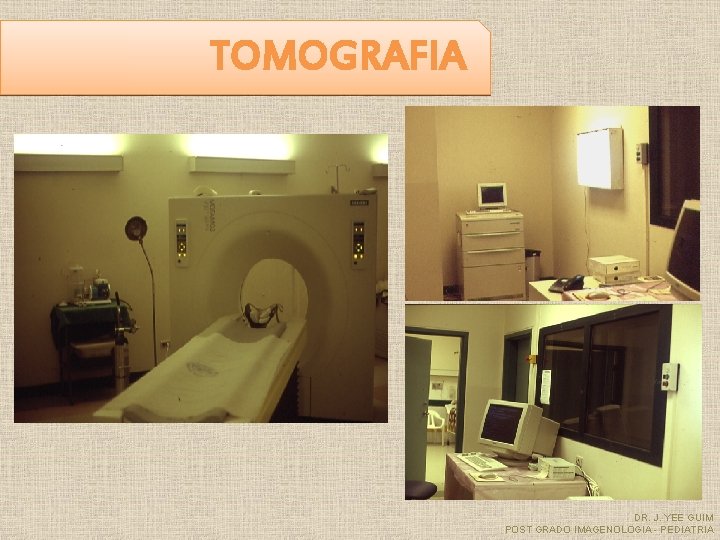 TOMOGRAFIA DR. J. YEE GUIM POST GRADO IMAGENOLOGIA - PEDIATRIA 