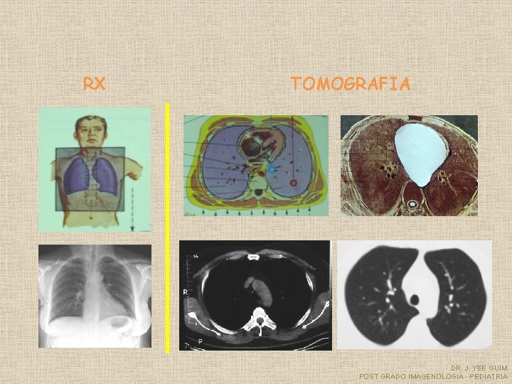RX TOMOGRAFIA DR. J. YEE GUIM POST GRADO IMAGENOLOGIA - PEDIATRIA 