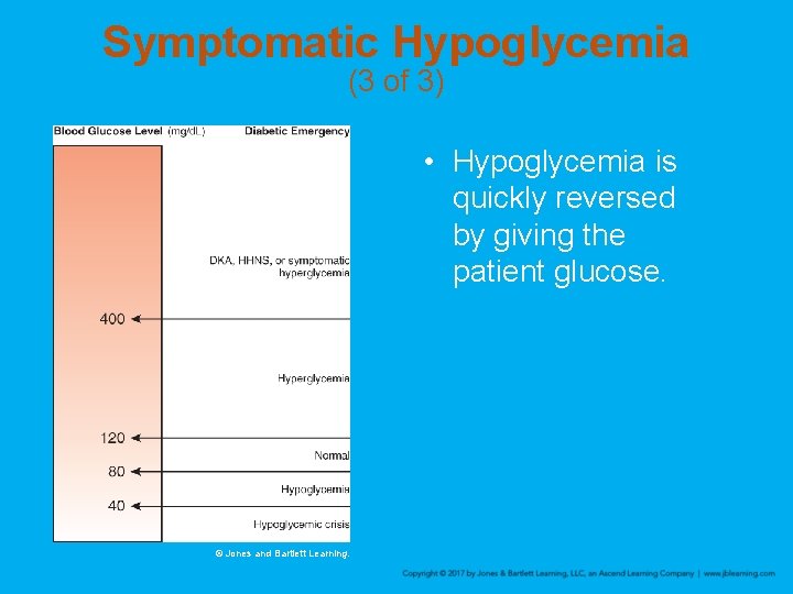 Symptomatic Hypoglycemia (3 of 3) • Hypoglycemia is quickly reversed by giving the patient