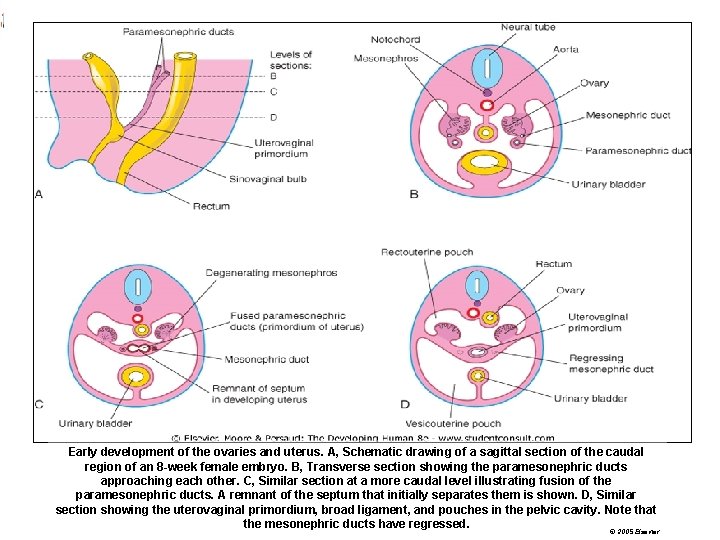 Early development of the ovaries and uterus. A, Schematic drawing of a sagittal section
