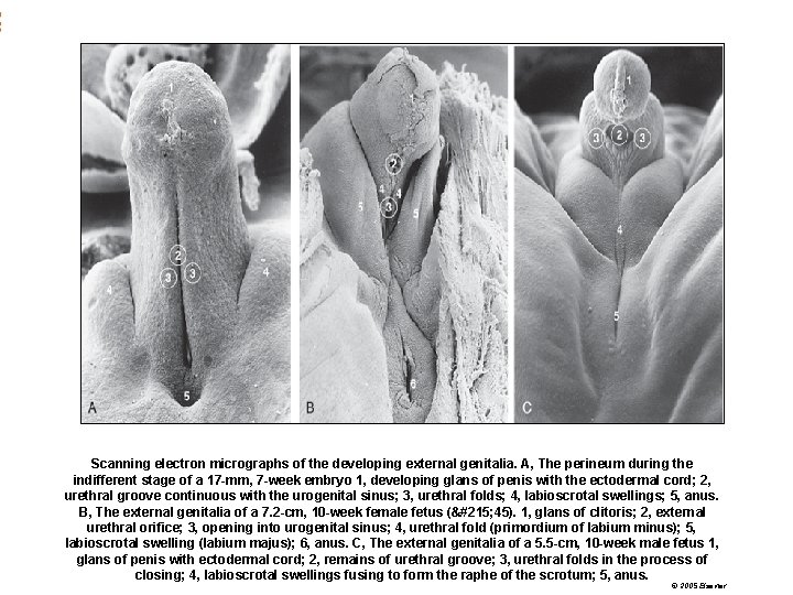 Scanning electron micrographs of the developing external genitalia. A, The perineum during the indifferent