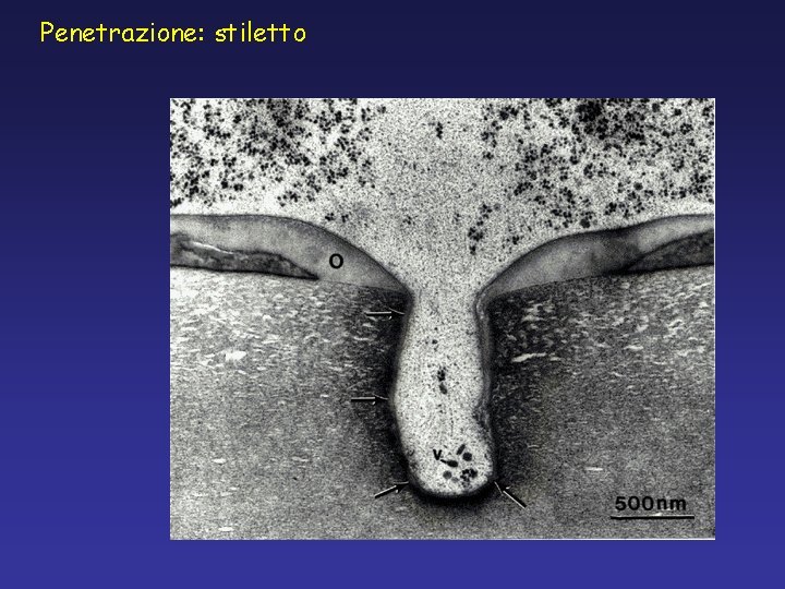 Penetrazione: stiletto Penetrazione: stiletto