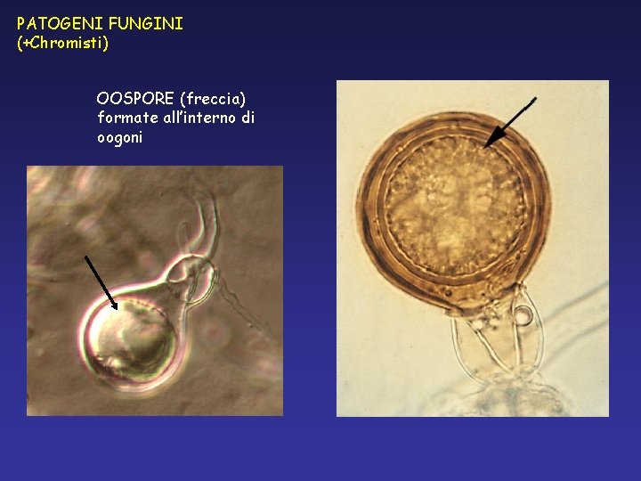 PATOGENI FUNGINI (+Chromisti) OOSPORE (freccia) formate all’interno di oogoni PATOGENI FUNGINI (+Chromisti) OOSPORE (freccia) formate all’interno di oogoni