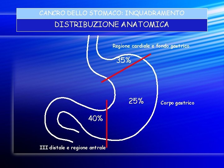 CANCRO DELLO STOMACO: INQUADRAMENTO DISTRIBUZIONE ANATOMICA Regione cardiale e fondo gastrico 35% 25% 40%