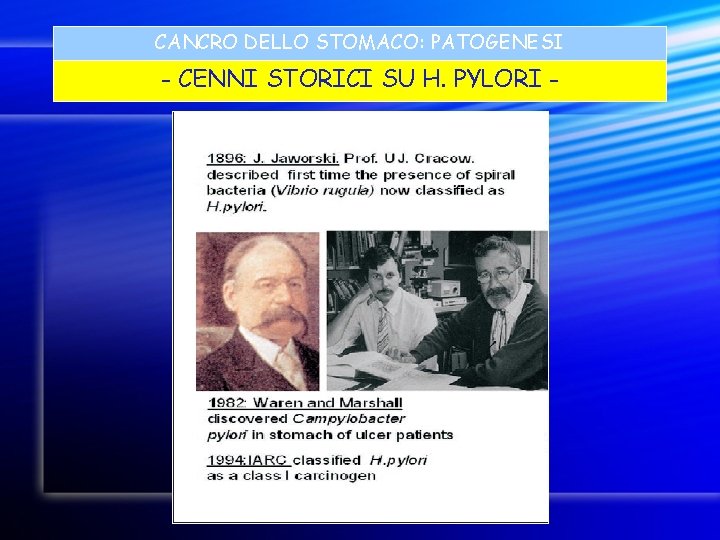 CANCRO DELLO STOMACO: PATOGENESI - CENNI STORICI SU H. PYLORI - 
