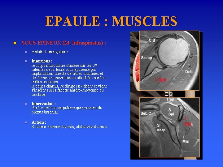 EPAULE : MUSCLES n SOUS EPINEUX (M. Infraspinatus) : n Aplati et triangulaire n