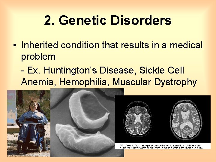 2. Genetic Disorders • Inherited condition that results in a medical problem - Ex.