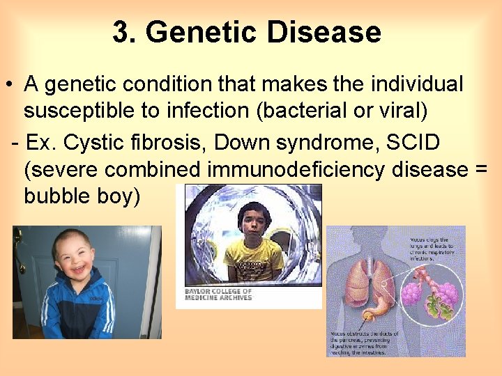 3. Genetic Disease • A genetic condition that makes the individual susceptible to infection