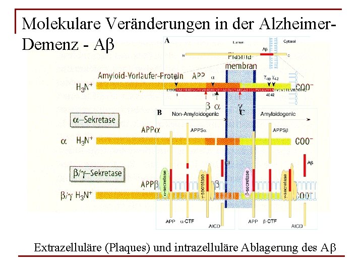 Molekulare Veränderungen in der Alzheimer. Demenz - Ab Extrazelluläre (Plaques) und intrazelluläre Ablagerung des