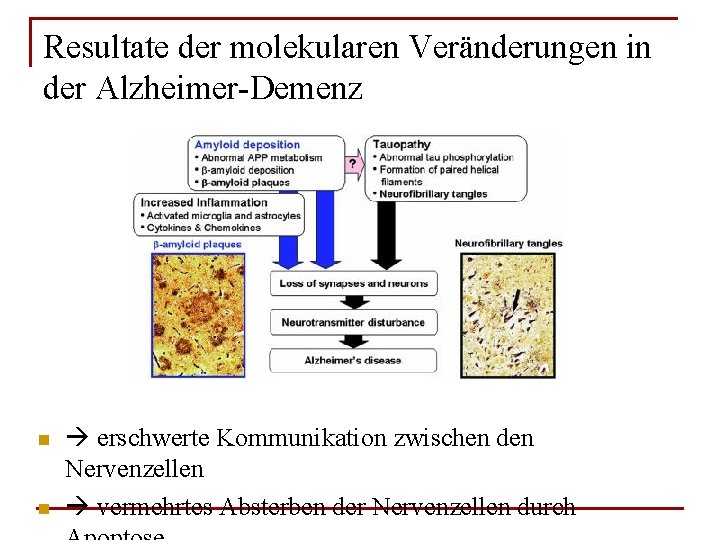 Resultate der molekularen Veränderungen in der Alzheimer-Demenz n n erschwerte Kommunikation zwischen den Nervenzellen