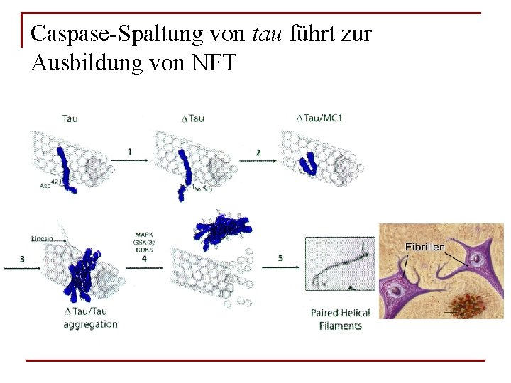 Caspase-Spaltung von tau führt zur Ausbildung von NFT 