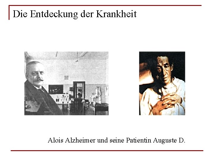 Die Entdeckung der Krankheit Alois Alzheimer und seine Patientin Auguste D. 