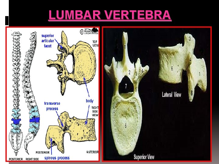 LUMBAR VERTEBRA 