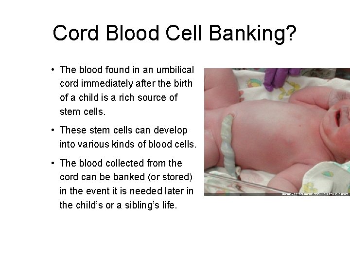 Cord Blood Cell Banking? • The blood found in an umbilical cord immediately after