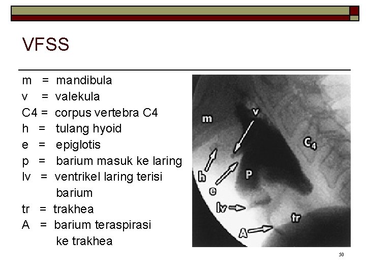 VFSS m = v = C 4 = h = e = p =