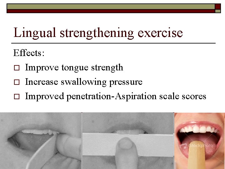 Lingual strengthening exercise Effects: o Improve tongue strength o Increase swallowing pressure o Improved