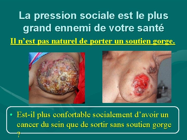 La pression sociale est le plus grand ennemi de votre santé Il n’est pas