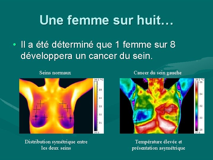 Une femme sur huit… • Il a été déterminé que 1 femme sur 8