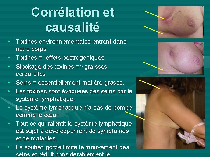 Corrélation et causalité • Toxines environnementales entrent dans notre corps • Toxines = effets