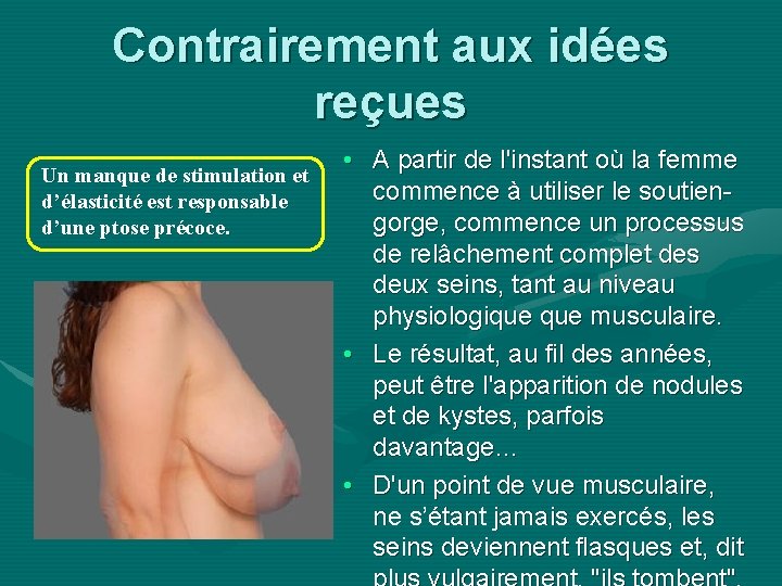 Contrairement aux idées reçues Un manque de stimulation et d’élasticité est responsable d’une ptose