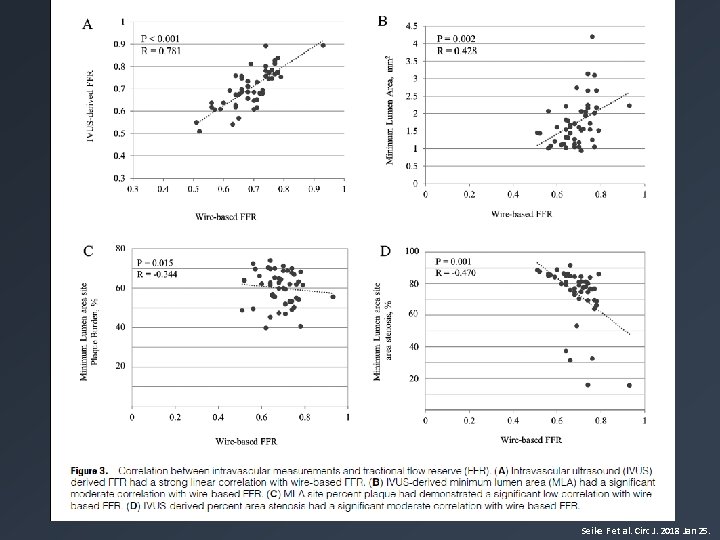 Seike F et al. Circ J. 2018 Jan 25. 