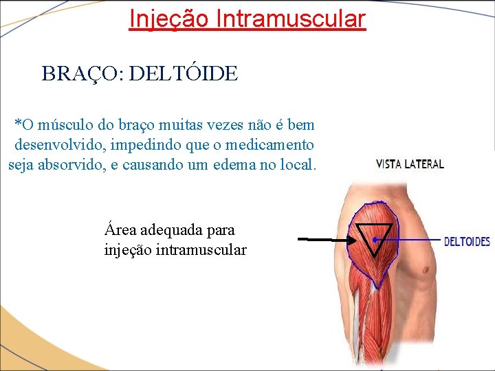 Injeção Intramuscular BRAÇO: DELTÓIDE *O músculo do braço muitas vezes não é bem desenvolvido,