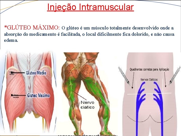 Injeção Intramuscular *GLÚTEO MÁXIMO: O glúteo é um músculo totalmente desenvolvido onde a absorção