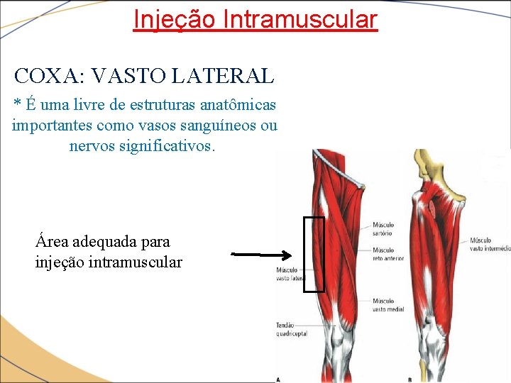 Injeção Intramuscular COXA: VASTO LATERAL * É uma livre de estruturas anatômicas importantes como