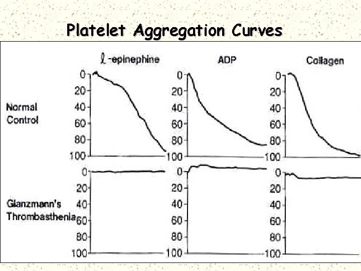 Platelet Aggregation Curves 