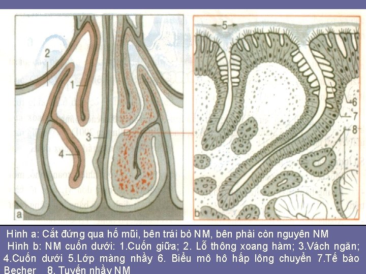 Hình a: Cắt đứng qua hố mũi, bên trái bỏ NM, bên phải còn Hình a: Cắt đứng qua hố mũi, bên trái bỏ NM, bên phải còn
