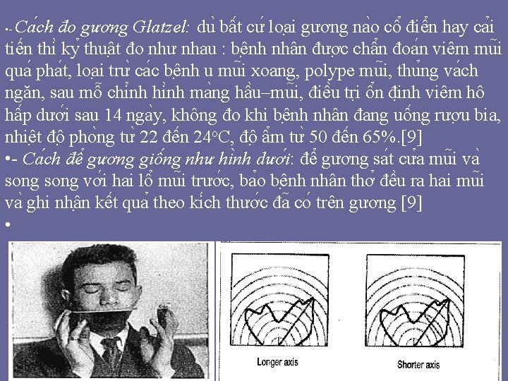 Ca ch đo gương Glatzel: du bâ t cư loa i gương na o Ca ch đo gương Glatzel: du bâ t cư loa i gương na o
