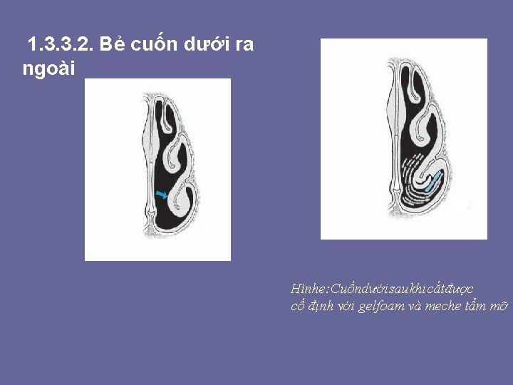 1. 3. 3. 2. Bẻ cuốn dưới ra ngoài Hình e: Cuốn dưới sau 1. 3. 3. 2. Bẻ cuốn dưới ra ngoài Hình e: Cuốn dưới sau