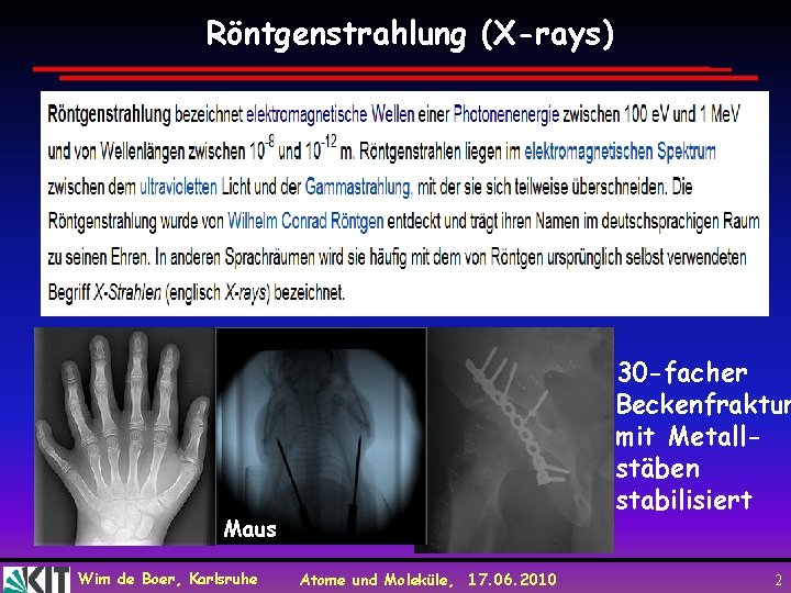 Röntgenstrahlung (X-rays) 30 -facher Beckenfraktur mit Metallstäben stabilisiert Maus Wim de Boer, Karlsruhe Atome