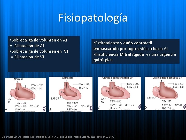 Fisiopatología • Sobrecarga de volumen en AI = Dilatación de AI • Sobrecarga de