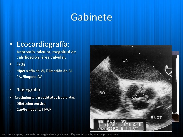 Gabinete • Ecocardiografía: Anatomía valvular, magnitud de calcificación, área valvular. • ECG - Hipertrofia